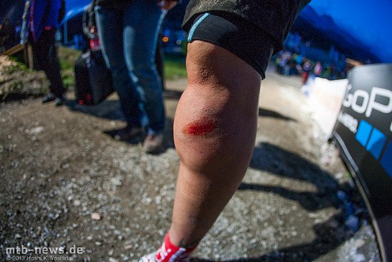 Anneke Beertens Bein