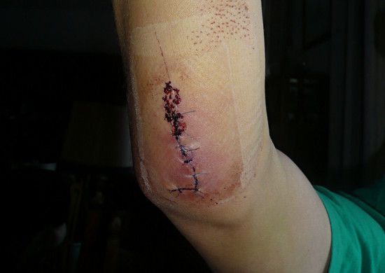cycling is war