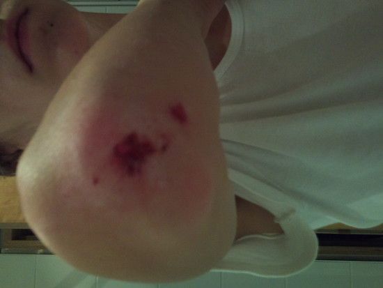 nachdemCrashbeimDropVitalis