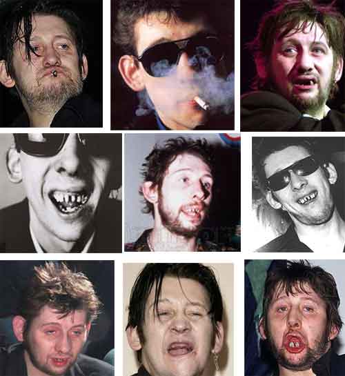 Shane MacGowan