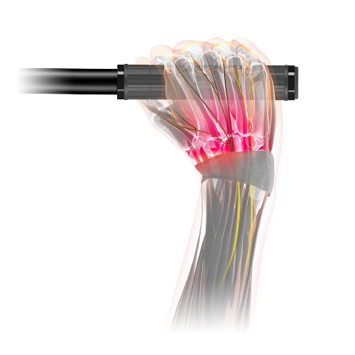 Ursache – falsche Lenkerposition